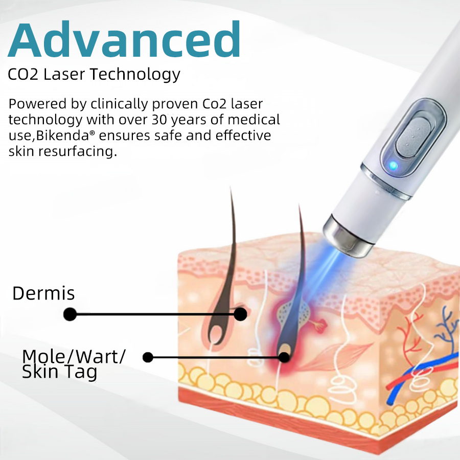 DermaZap® | Professional CO₂ Laser Pen for Flawless Skin at Home