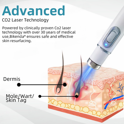 DermaZap® | Professional CO₂ Laser Pen for Flawless Skin at Home
