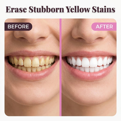 Whitening Toothpaste - Bright Smile Without Harsh Treatments
