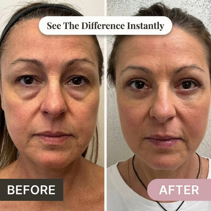 Instant Eye Cream — Visibly Smooths Dark Circles, Puffiness & Fine Lines
