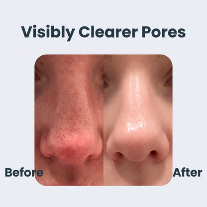 Cleansing Mask - Clear Pores and Smooth Skin Without Harsh Treatments
