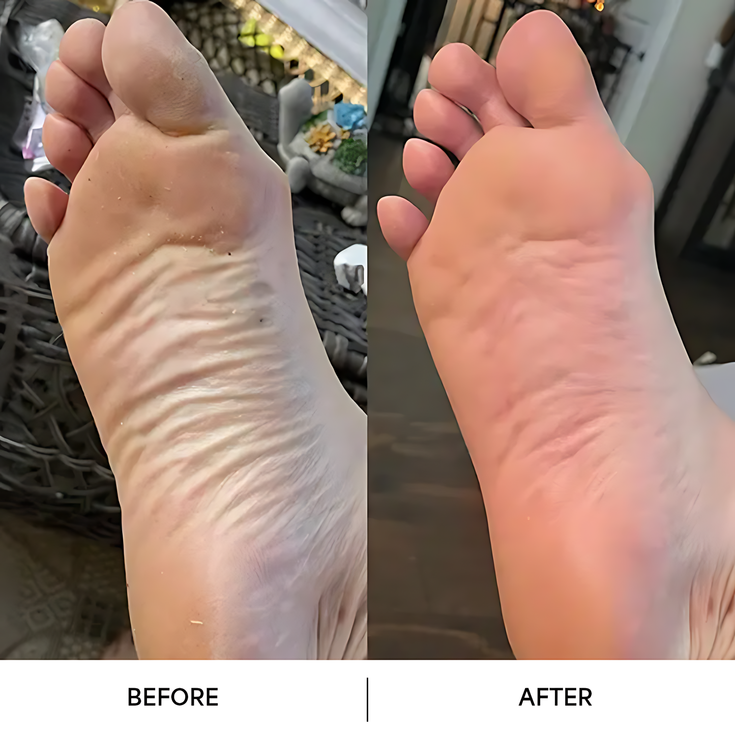 מכשיר לטחינת רגליים חשמלי - עור חלק בלי שפשוף חזק