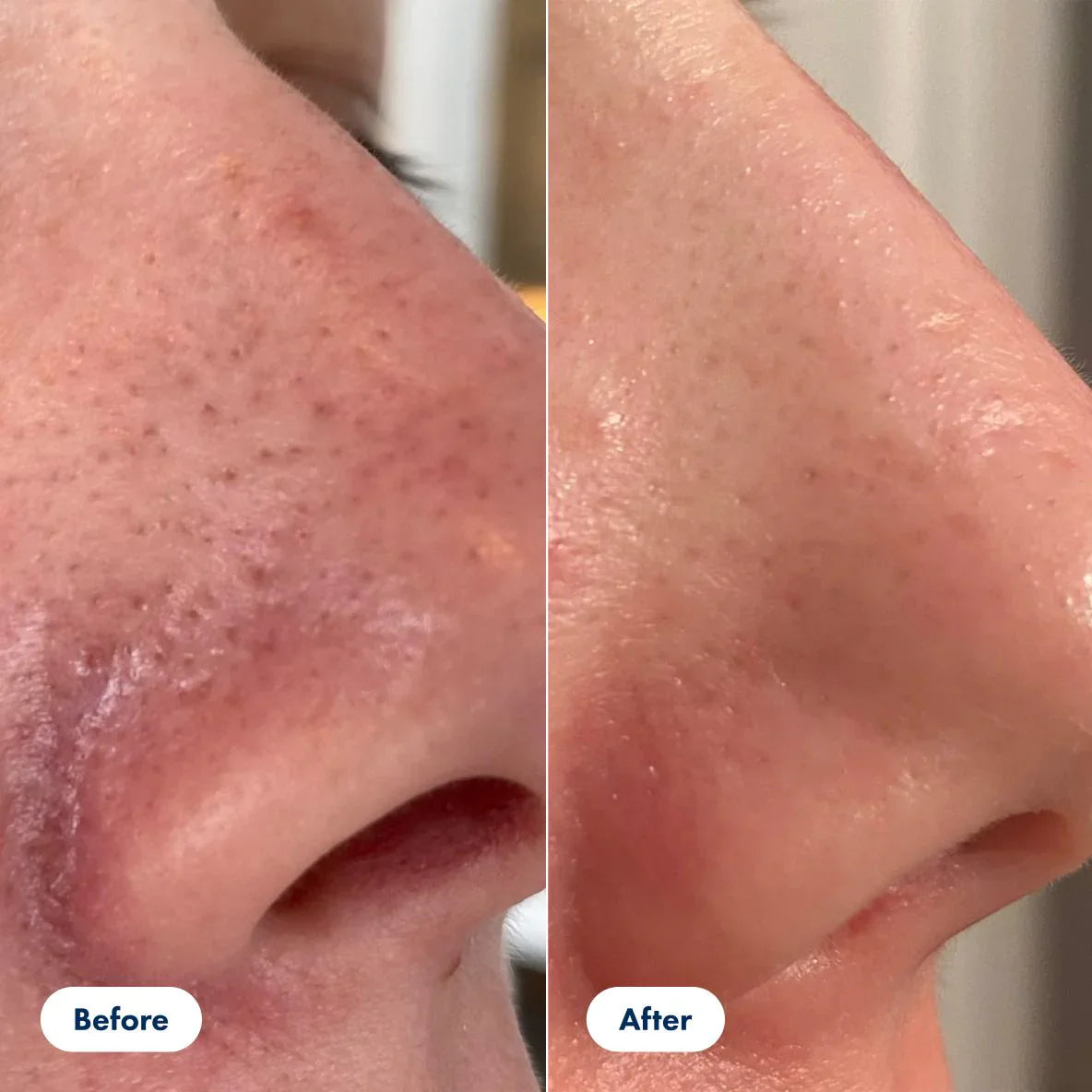 Siero Rassodante per i Pori - Pelle Liscia e Radiosa Senza Trucco Pesante