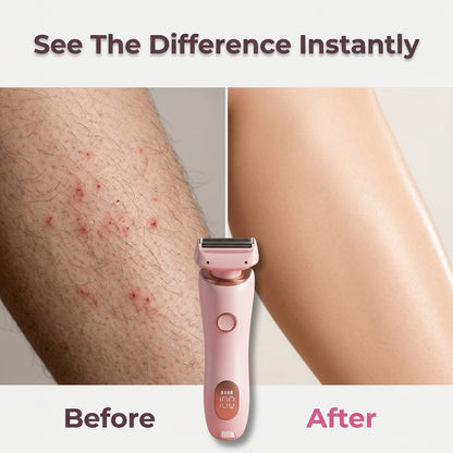 Electric Hair Removal Device - Smooth Skin Without Cuts From Shaving