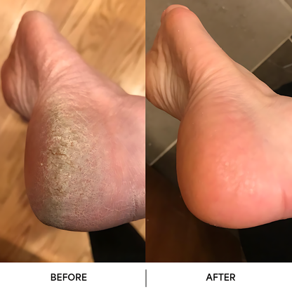 מכשיר לטחינת רגליים חשמלי - עור חלק בלי שפשוף חזק