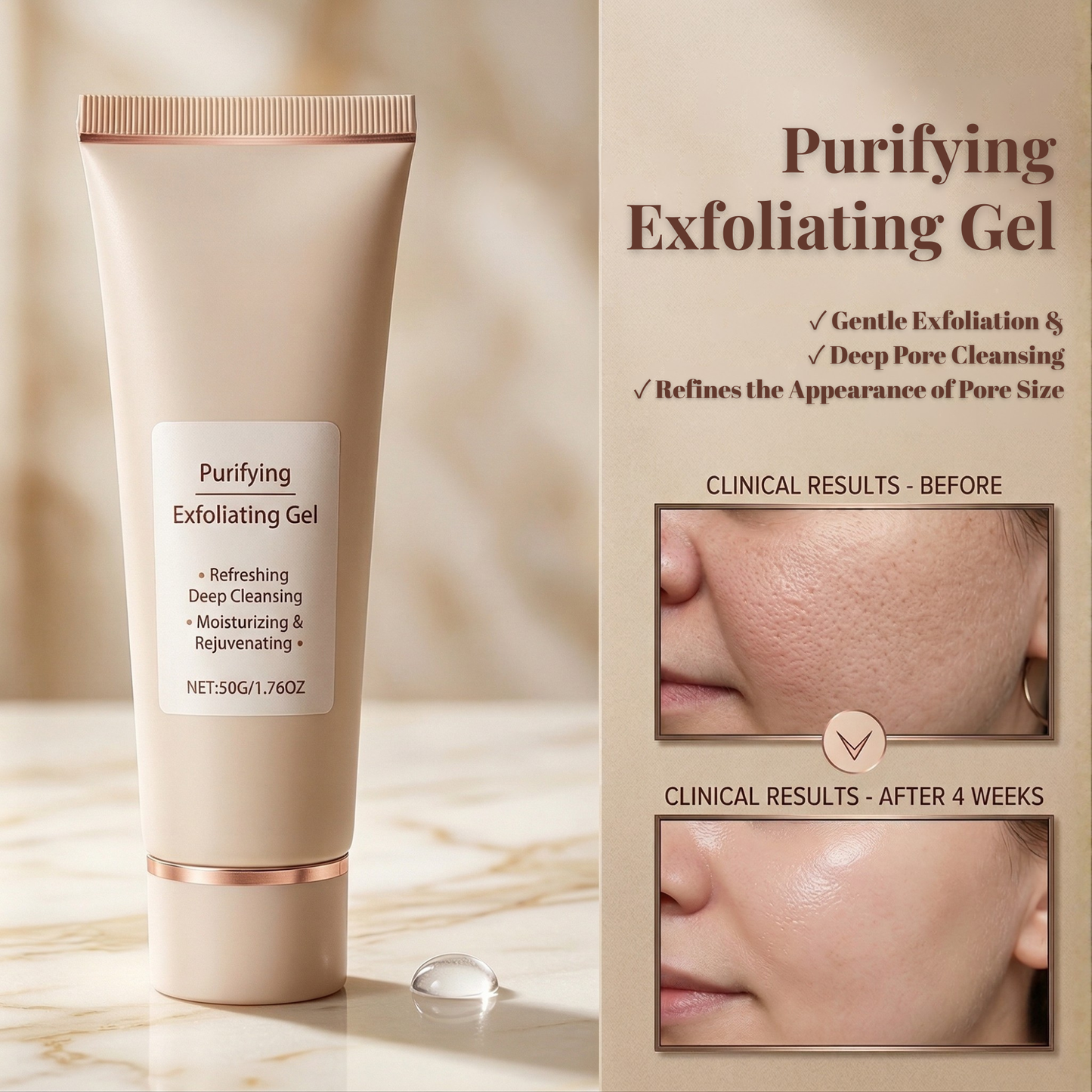 ג׳ל פילינג להסרת תאים מתים - עור חלק וזוהר ללא שפשוף חזק