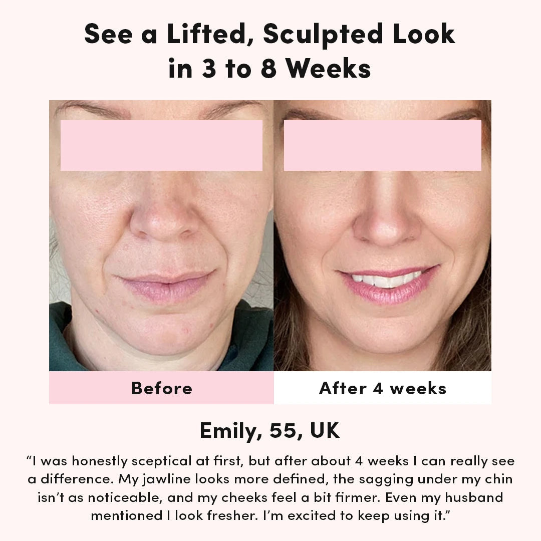 Dispositivo per il Lifting Facciale - Ama di Nuovo il Tuo Riflesso Senza Trattamenti Costosi