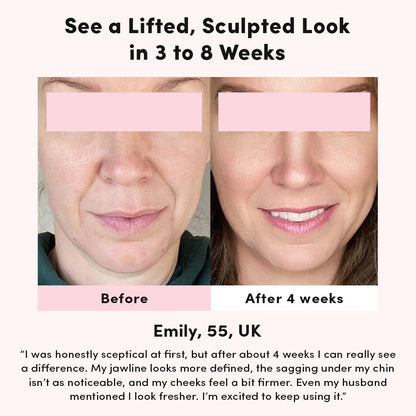 Dispositivo per il Lifting Facciale - Ama di Nuovo il Tuo Riflesso Senza Trattamenti Costosi