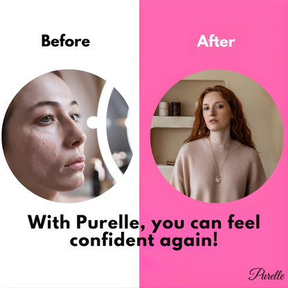 Purelle™ - Pore-Perfecting Cream inspired by South Korea