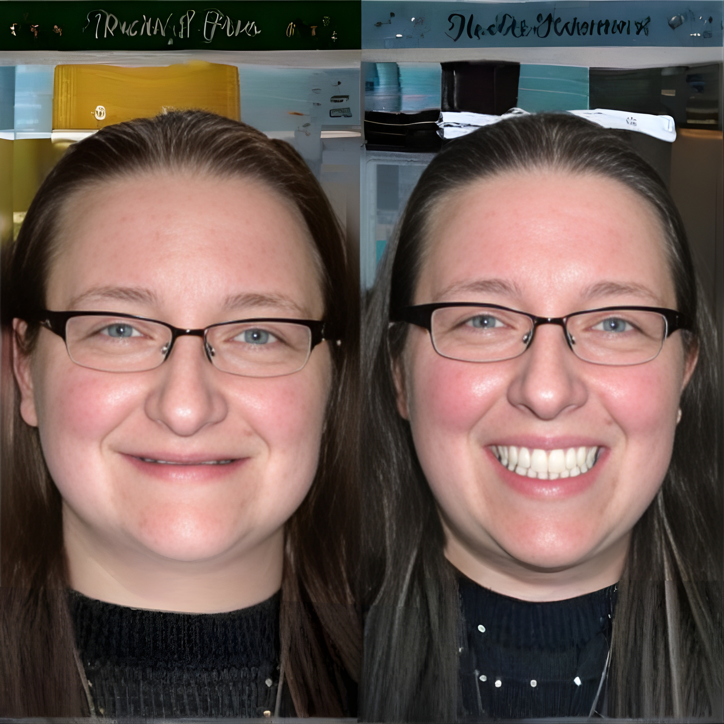 Zvykle tvarované zubní protézy - Sebevědomí bez volných protéz