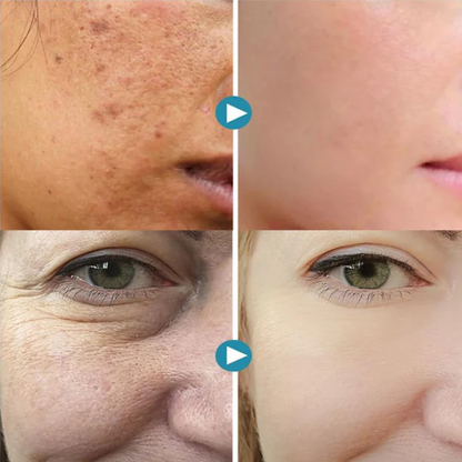 Purelle™ - Pore-Perfecting Cream inspired by South Korea