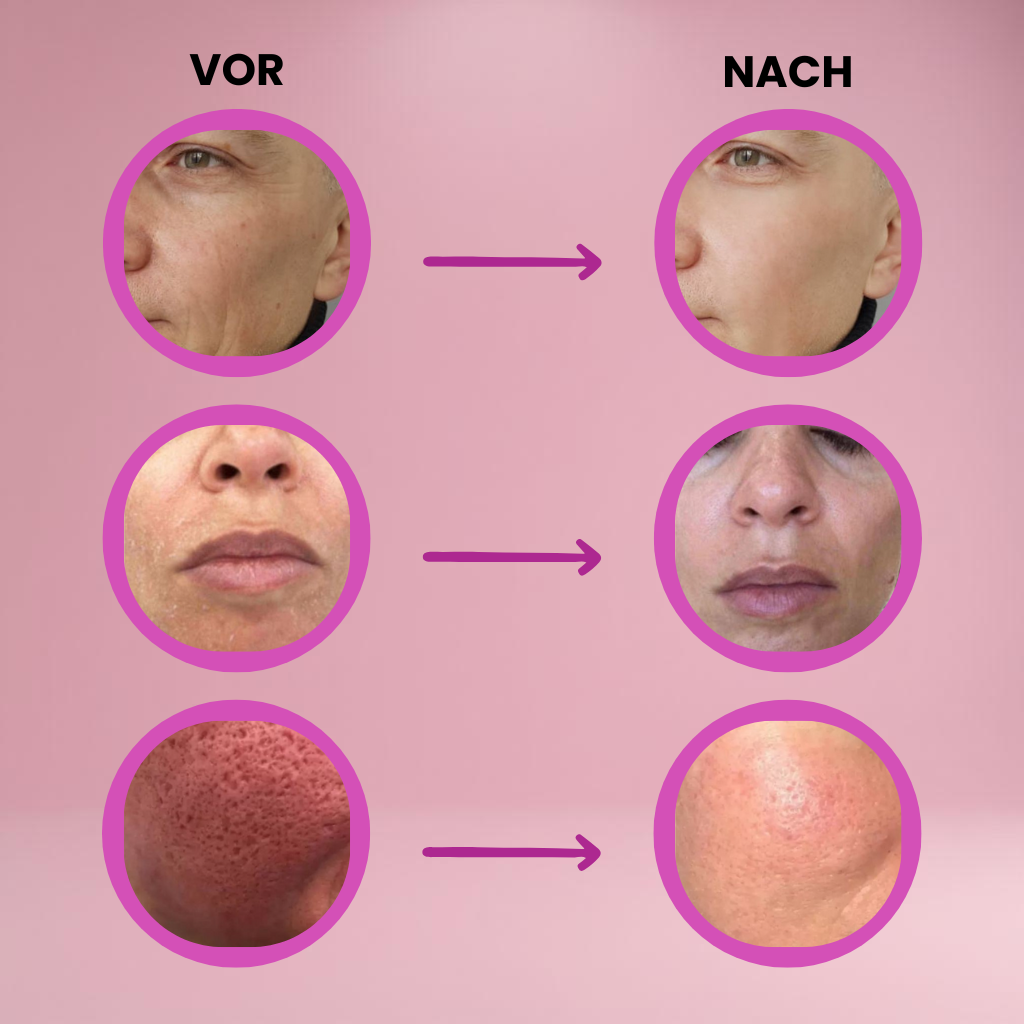 DEROL multi balm stick in peach packaging with orange lettering, hydrating skincare balm for face, lips, and body