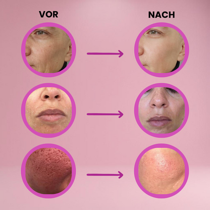 DEROL multi balm stick in peach packaging with orange lettering, hydrating skincare balm for face, lips, and body